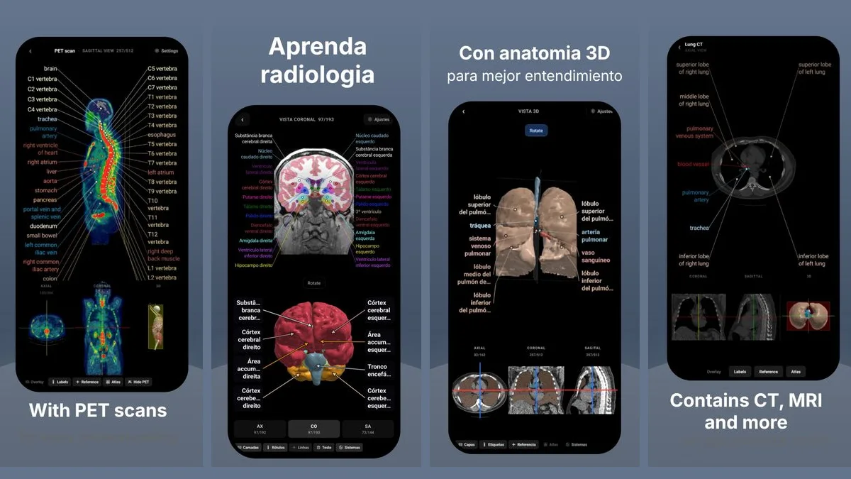 Four screens of the RadioAnato AI app: a labelled PET scan, a brain MRI with a 3D brain, 3D lungs with CT slices, and a labelled lung CT