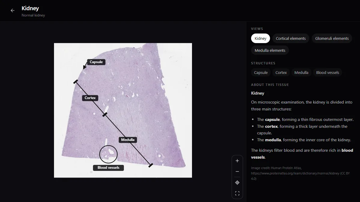 Whole-slide section of a normal kidney in the RadioAnatomy histology atlas, with the capsule, cortex, medulla and blood vessels labelled