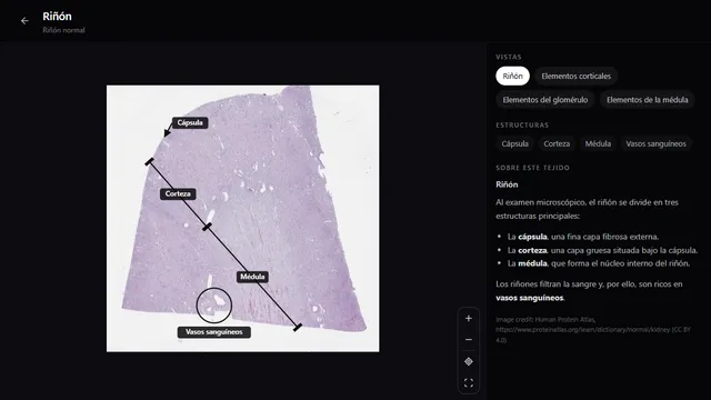 Preparación completa de un riñón normal en el atlas de histología de RadioAnatomy, con la cápsula, la corteza, la médula y los vasos sanguíneos rotulados