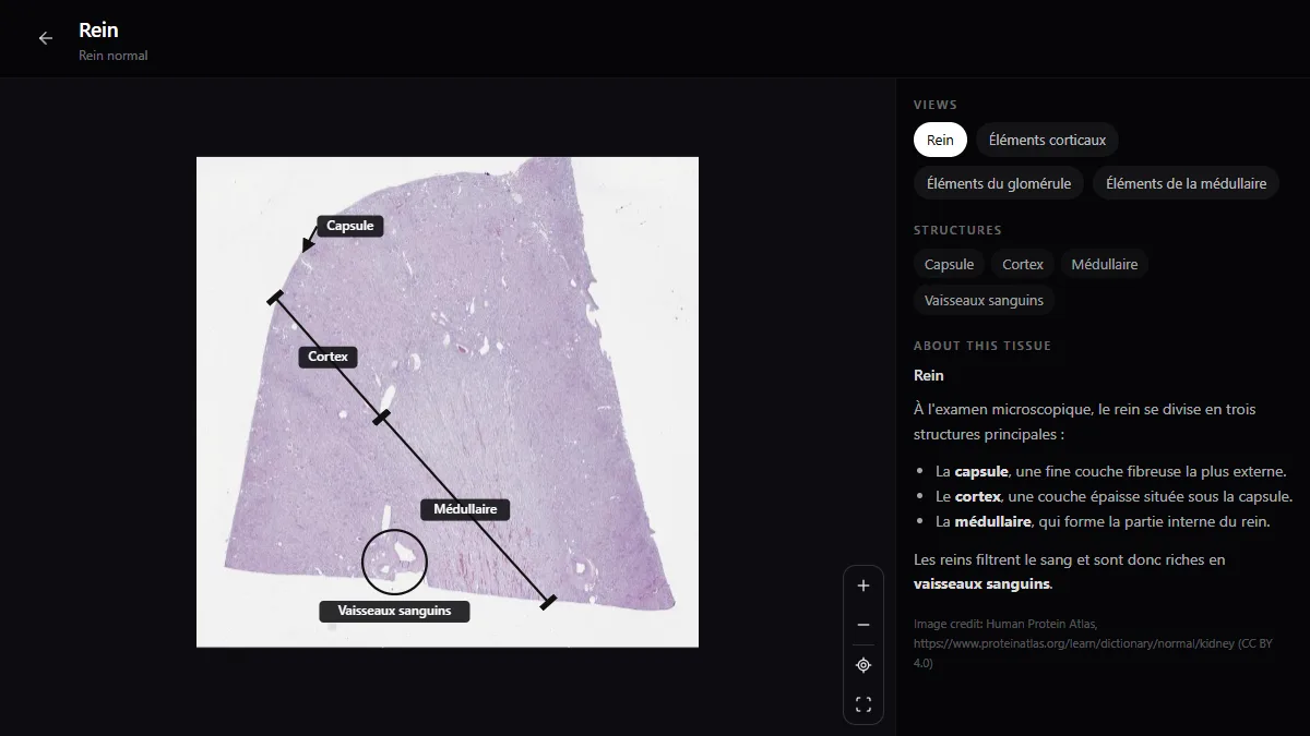 Lame entière d’un rein normal dans l’atlas d’histologie de RadioAnatomy, avec la capsule, le cortex, la médullaire et les vaisseaux sanguins légendés