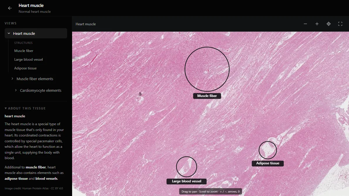 Heart muscle in the DecodeMed histology atlas, with muscle fibres, a large blood vessel and adipose tissue labelled