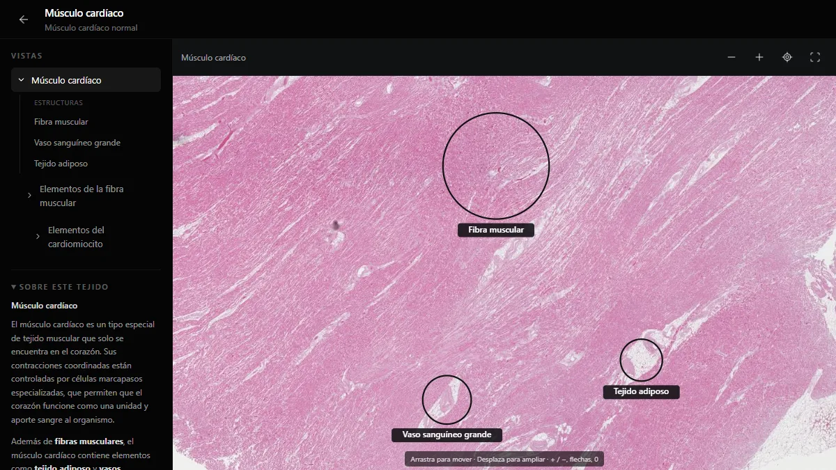 Músculo cardíaco en el atlas de histología de DecodeMed, con las fibras musculares, un vaso sanguíneo grande y tejido adiposo rotulados