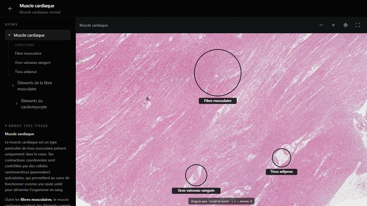 Muscle cardiaque dans l’atlas d’histologie de DecodeMed, avec les fibres musculaires, un gros vaisseau sanguin et du tissu adipeux légendés