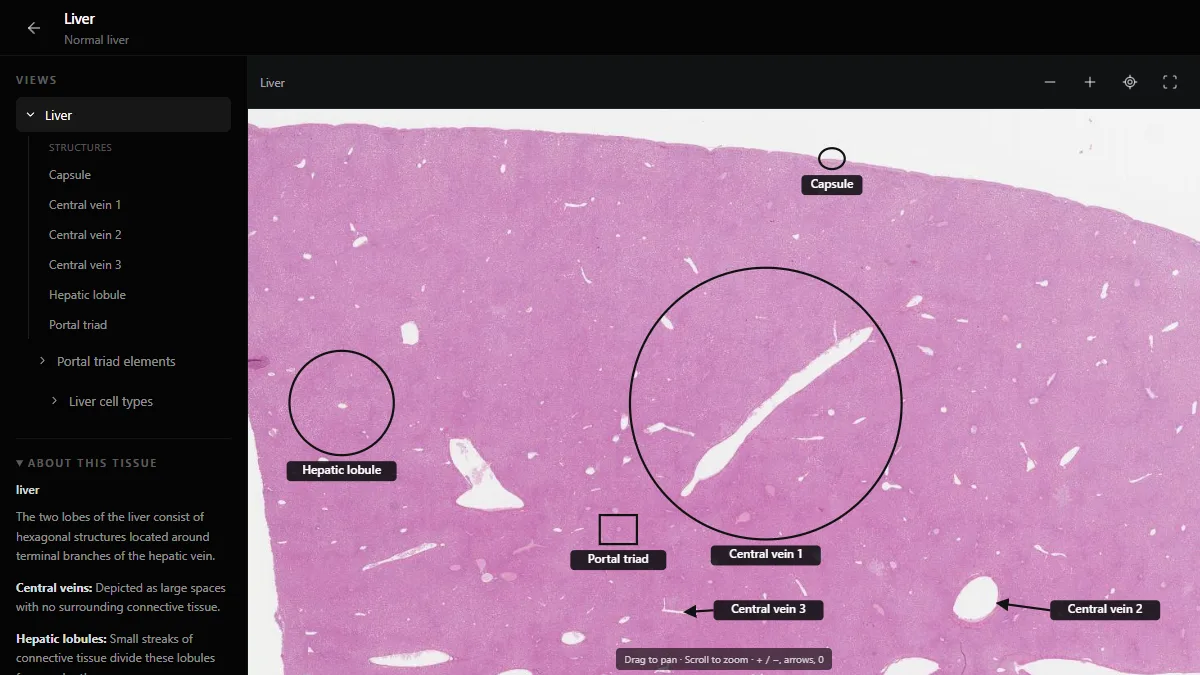 Normal liver in the DecodeMed histology atlas, with the capsule, a hepatic lobule, central veins and a portal triad labelled