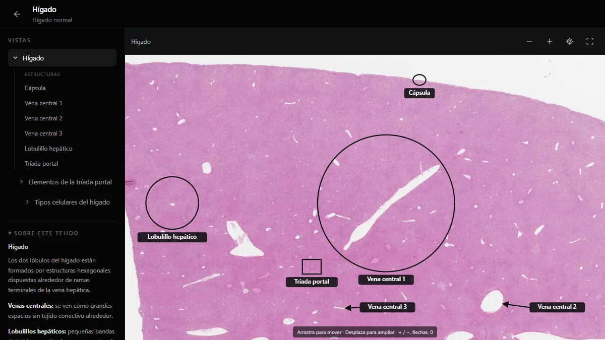Hígado normal en el atlas de histología de DecodeMed, con la cápsula, un lobulillo hepático, venas centrales y un espacio porta rotulados