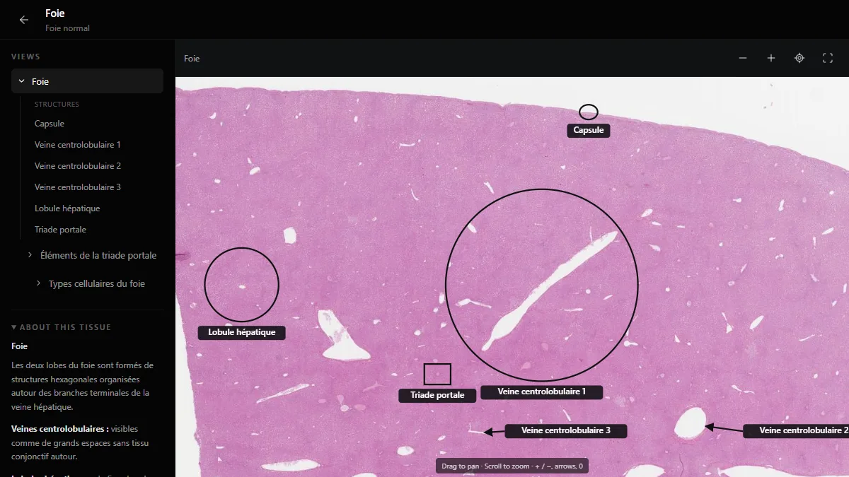 Foie normal dans l’atlas d’histologie de DecodeMed, avec la capsule, un lobule hépatique, des veines centrolobulaires et un espace porte légendés