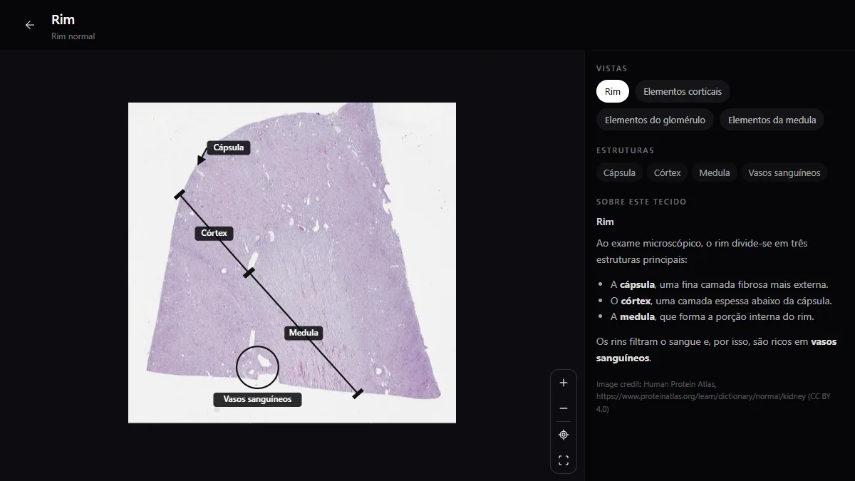 Lâmina inteira de um rim normal no atlas de histologia do RadioAnatomy, com a cápsula, o córtex, a medula e os vasos sanguíneos legendados